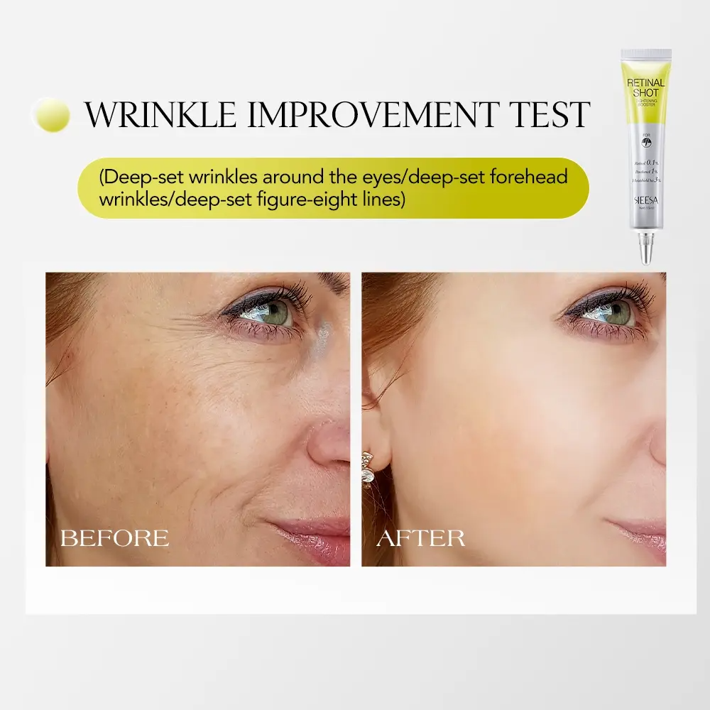 Retinal Shot Tightening Booster with Liposomized Retinal and Matryxyl, Pore-Minimizing