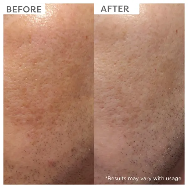 TruSkin Vitamin C Brightening Serum with Aloe, Jojoba Oil