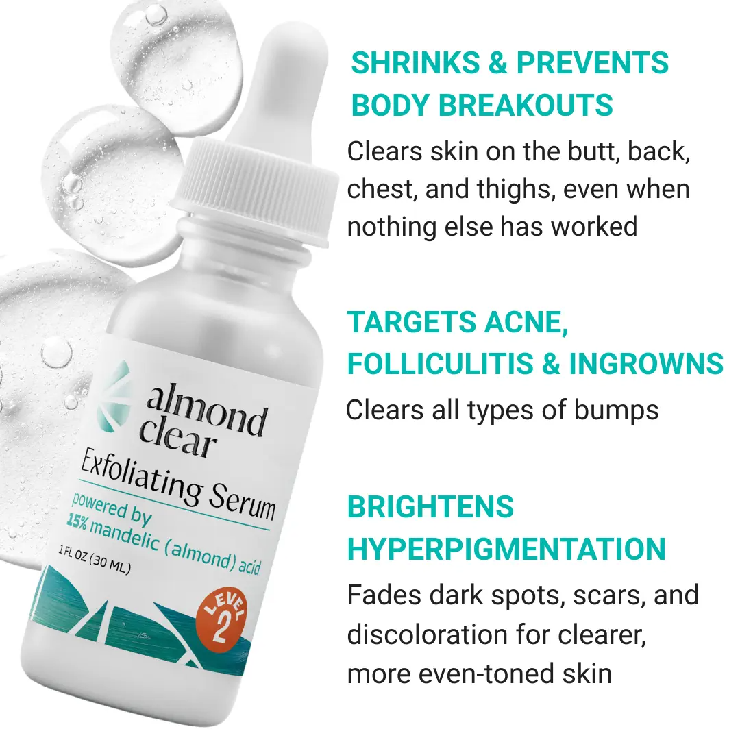 Level 2 Mandelic Acid Serum | Body Acne Treatment, Clear Butt Acne, Folliculitis