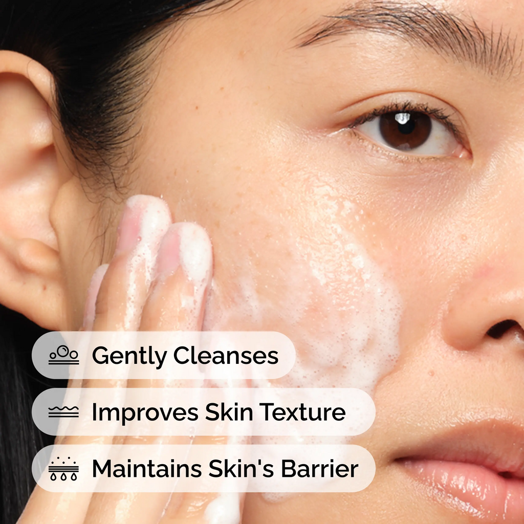 The Acne Set, 3-Step Skin Regimen with Glucoside Foaming Cleanser
