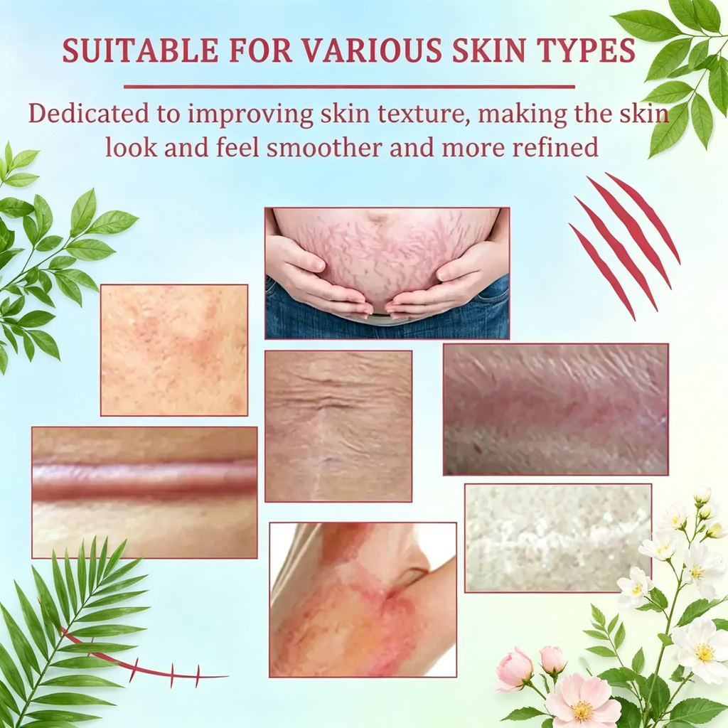 Scar Repair Cream 30g | Centella Asiatica & Shea Butter | Fades Post-Surgery, Keloid, Acne & Burn Scars