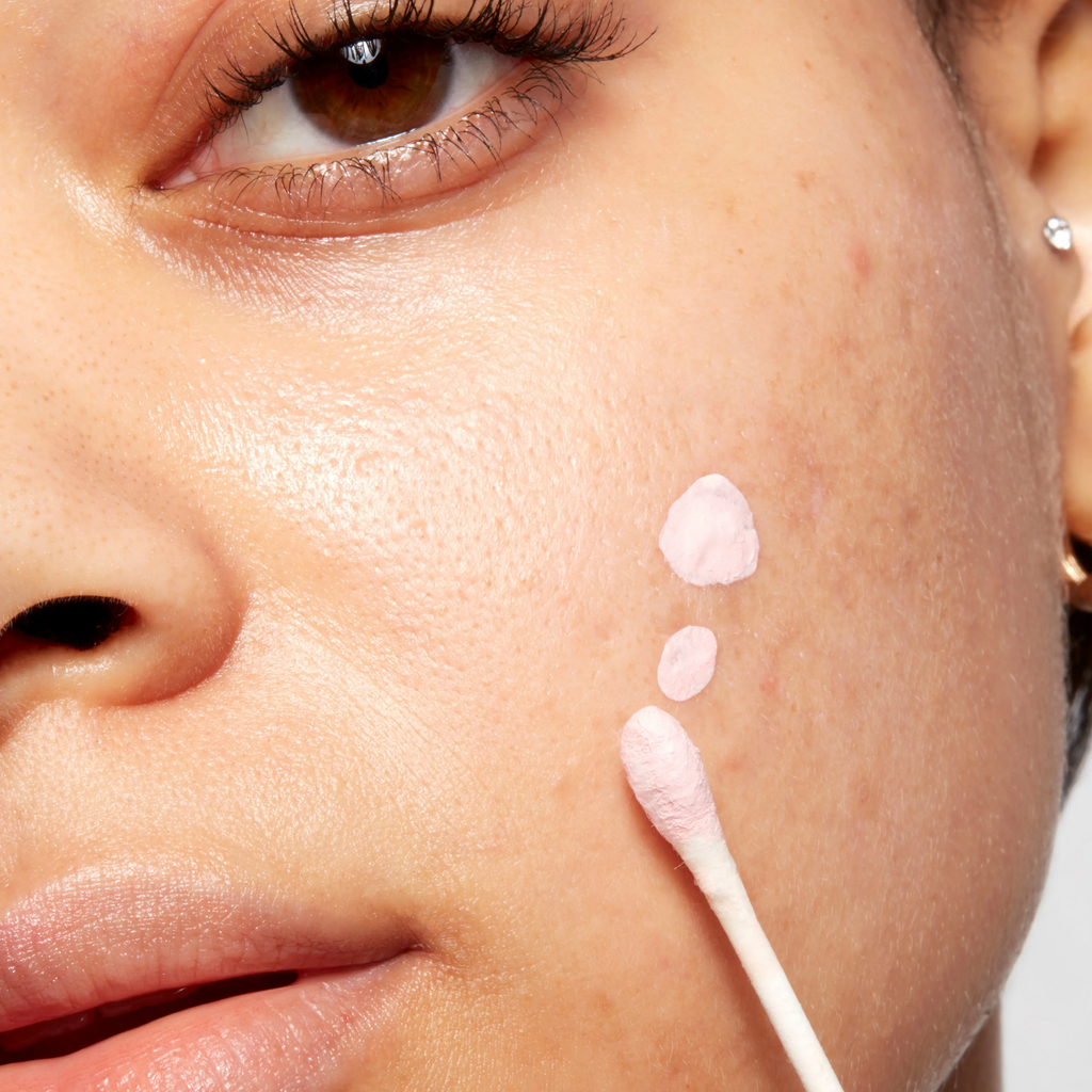 Drying Lotion - On-The-Spot Solution for Blemishes Skincare Acne Spot Treatment