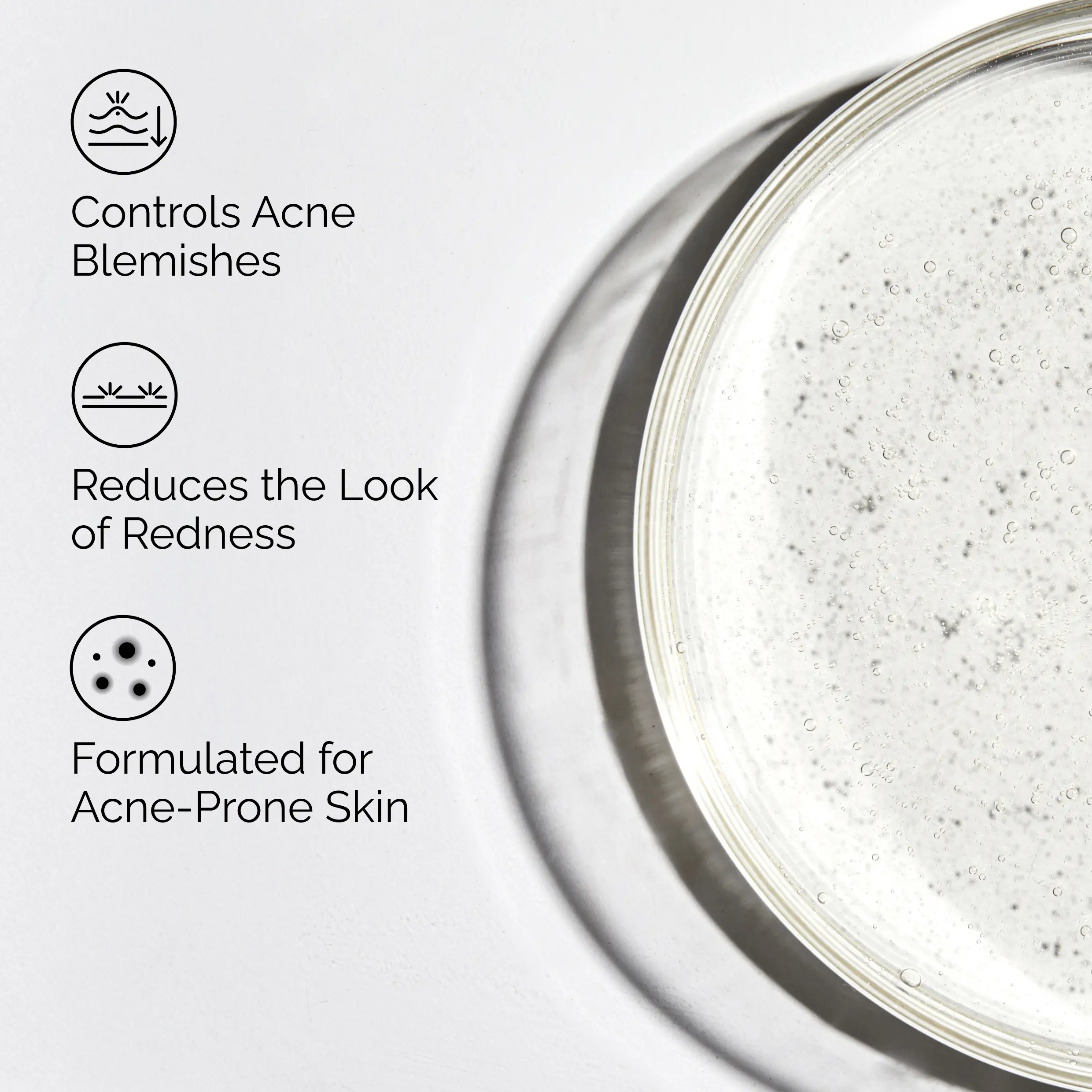 The Acne Set, 3-Step Skin Regimen with Glucoside Foaming Cleanser